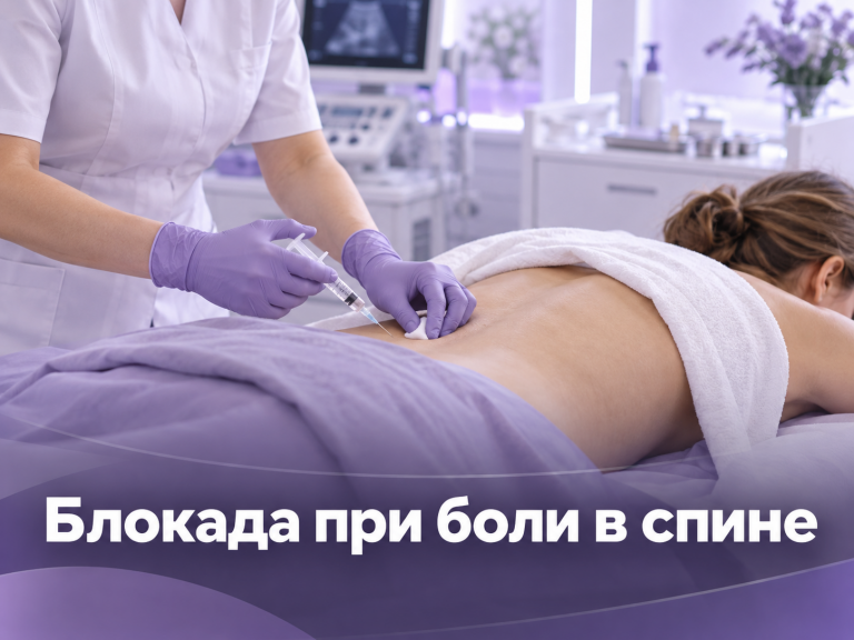 Обложка статьи о блокаде при боли в спине: врач готовит инъекцию в поясничную область пациента в клинике DR PROF